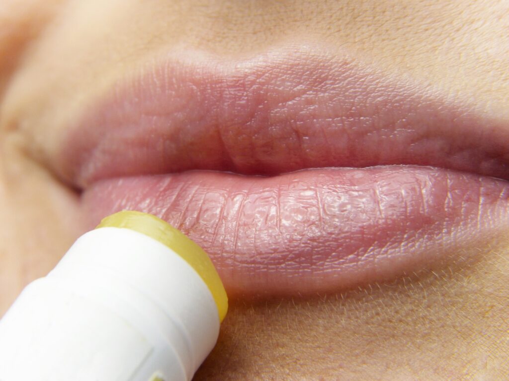 herpes - cold sore