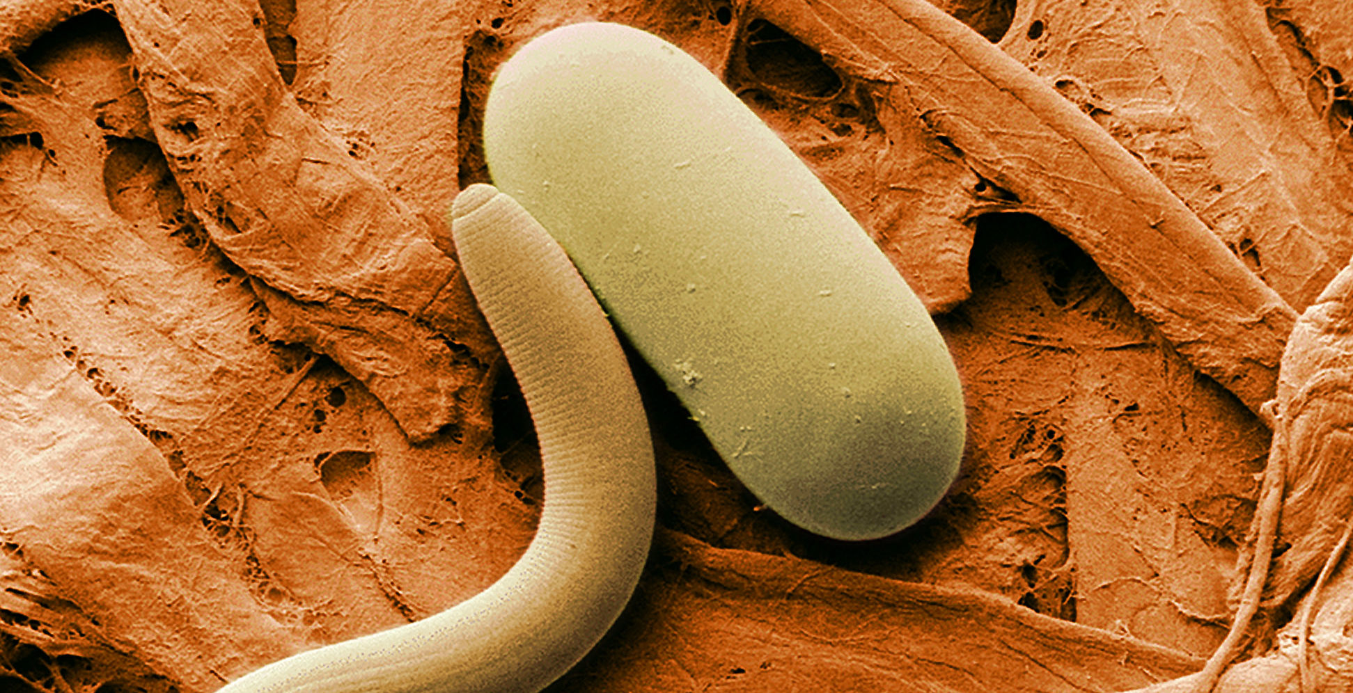 Parasitic Infection - Eliminate Parasites Naturally