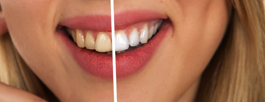 https://zh0.29a.myftpupload.com/wp-content/uploads/2019/Natural Remedies - Periodontal Disease